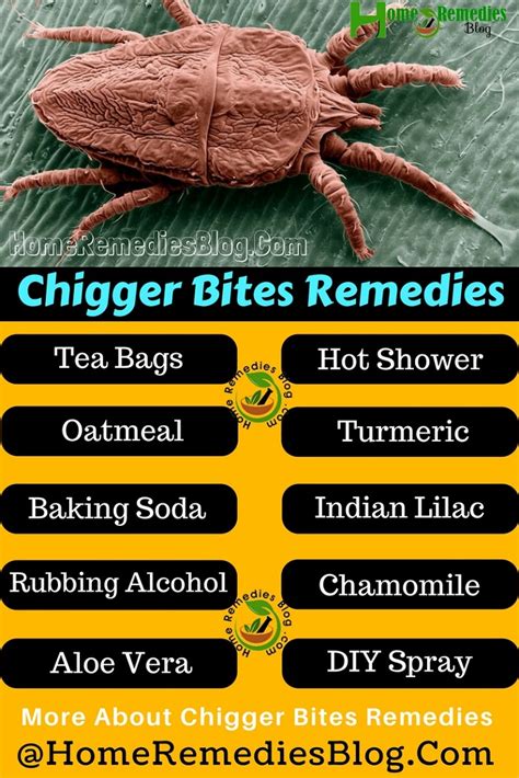 massage bites|Home Remedies for Chigger Bites, and When to See a Doctor.